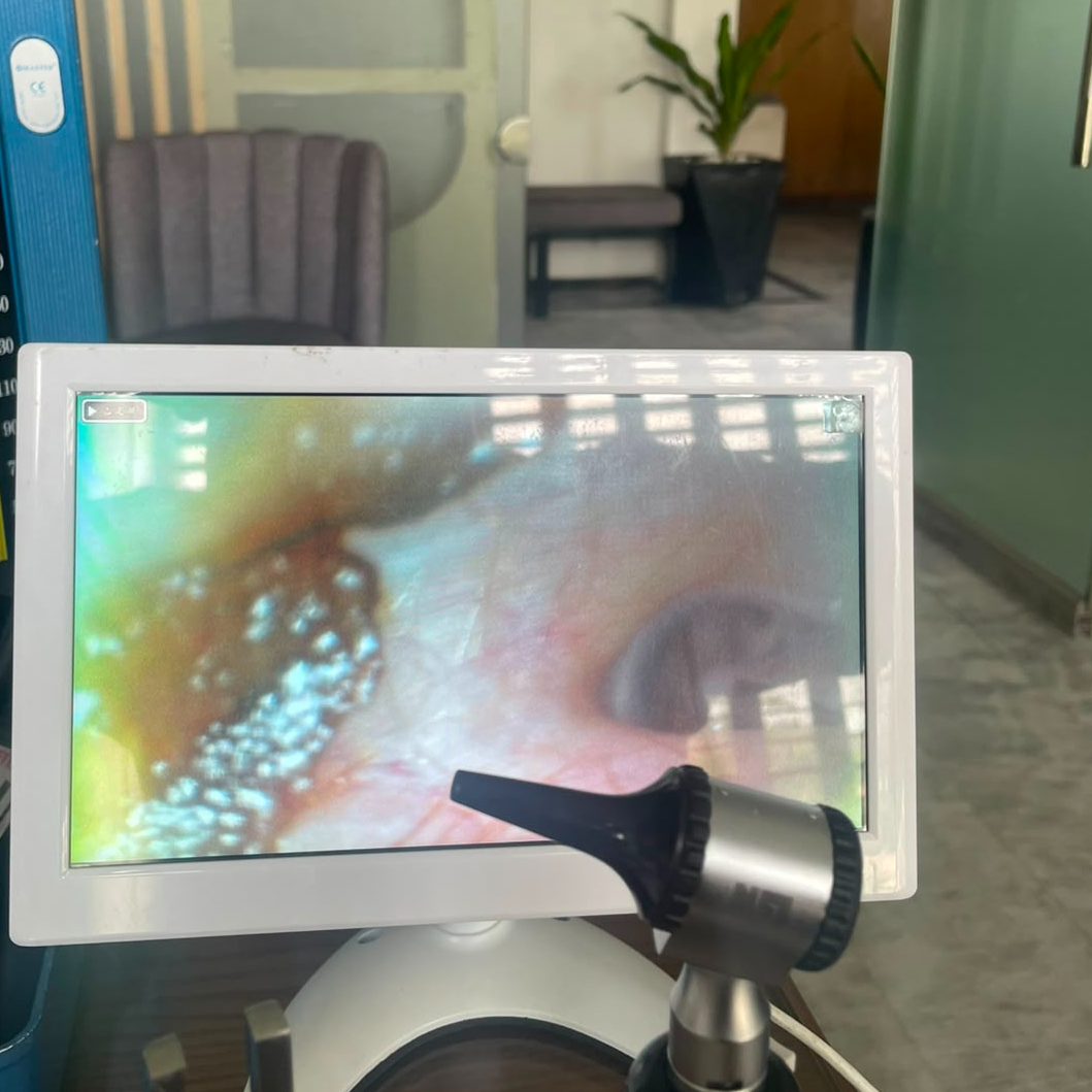 Dr. Ali Shayyan Live HD Otoscopy Camera Ear Examination